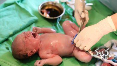 خون بند ناف