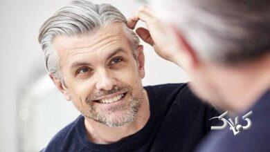 سفید شدن مو