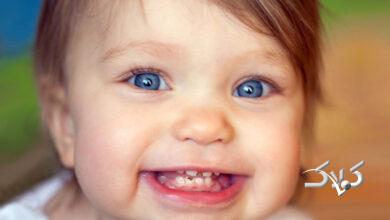 پوسیدگی دندان در کودکان