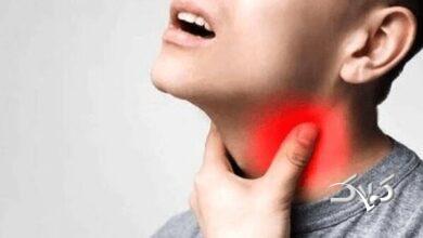 کرونای تیغی