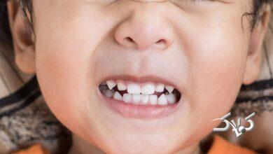 دندان قروچه