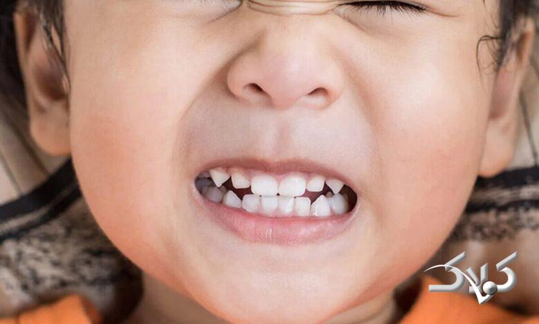 دندان قروچه