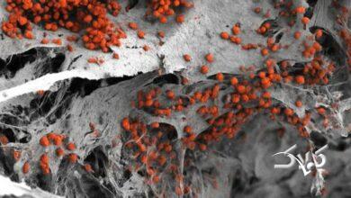 مغز استخوان