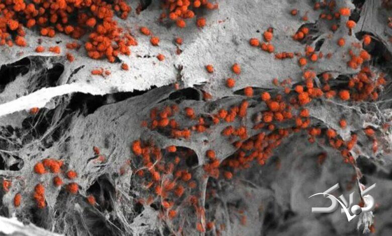 مغز استخوان