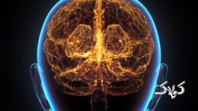 پیری سریع مغز