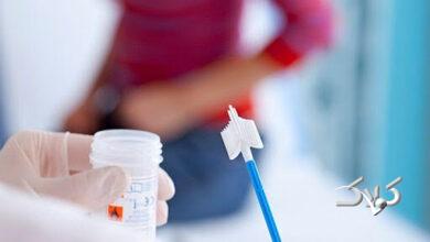 عفونت واژینال