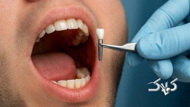 دندانپزشکی