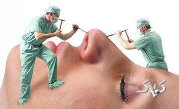 چرا شیادها در بازار جراحی زیبایی کاسبی شان پررونق است؟