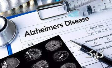 علائم اولیه شروع آلزایمر