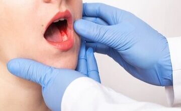 اصلیترین عوامل خطر در سرطان دهان چیست؟/ علائم هشدار دهنده