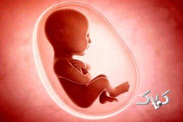 ۸۰ درصد شاکیان سقط جنین مردها هستند/ مواردی که قاضی اجازه سقط جنین قانونی نمی‌دهد
