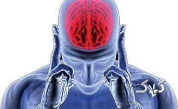 سکته مغزی در سالمندان/ تجربه «آلن دلون» از درمان تا انزوا