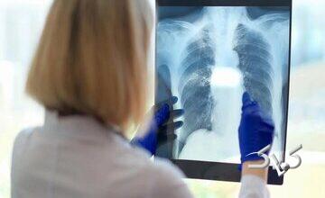 یک علت مهم و کمتر گفته شده درباره خستگی مزمن