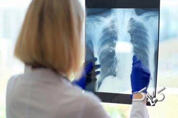 یک علت مهم و کمتر گفته شده درباره خستگی مزمن