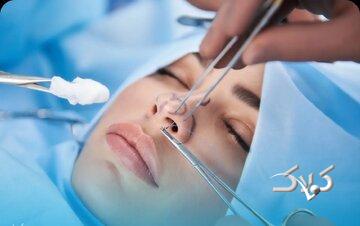 جراحی بینی بدون بیهوشی توسط دستیار دیپلمه پزشک
