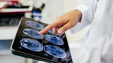 تغییر ساختار مغز انسان