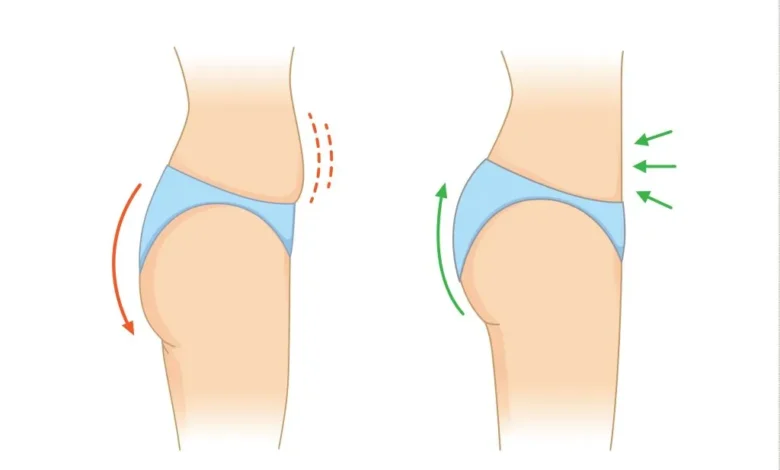 عمل لیفت باسن برزیلی