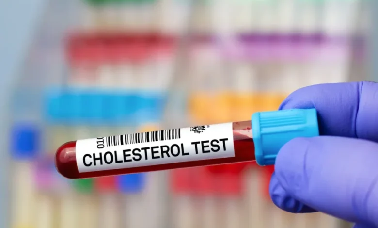 آزمایش کلسترول