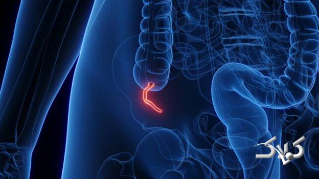 شیوع یک بیماری نادر میان جوانان پزشکان را نگران کرده