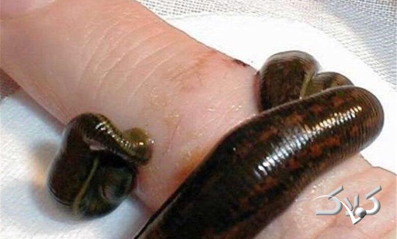 زالودرماني