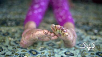 بیماران پروانهای