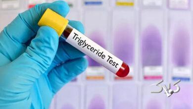 چربی خون - blood fat - کلسترول