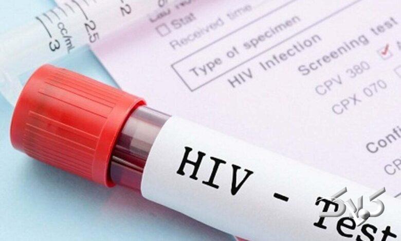 تست اچ آی وی - آزمایش اچ آی وی - HIV