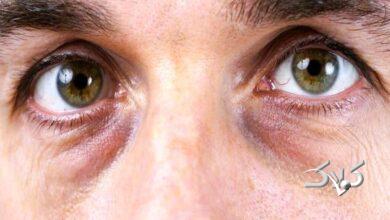 چشم پاندایی