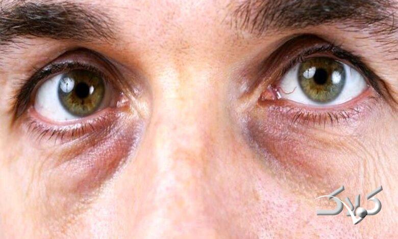 چشم پاندایی