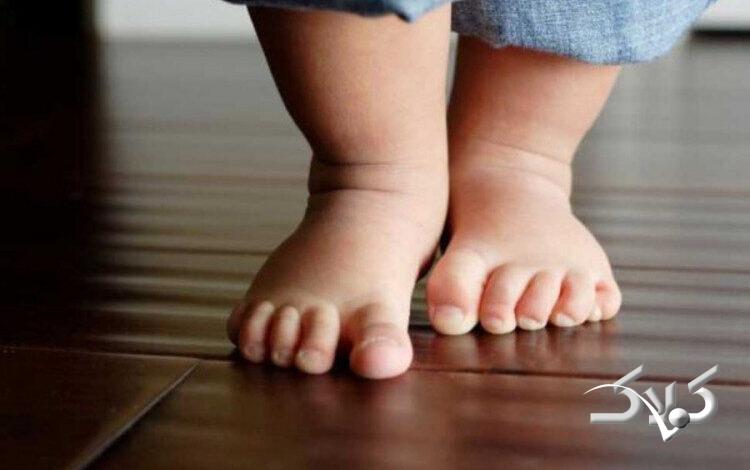 کف پای صاف در کودک