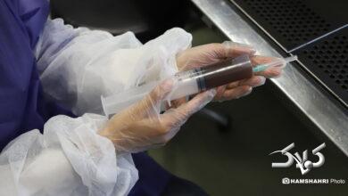 پیوند مدفوع