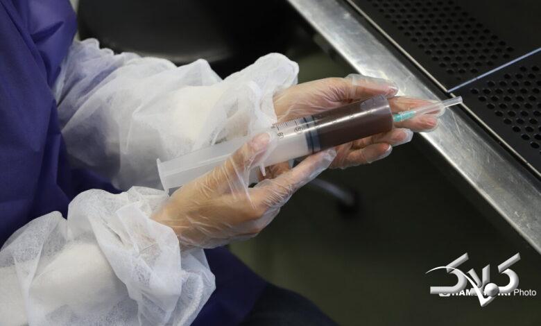 پیوند مدفوع