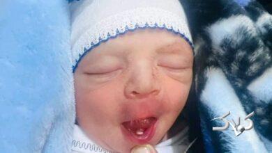 نوزاد عراقی با دندان به دنیا آمد