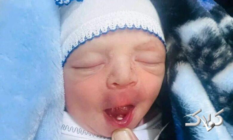 نوزاد عراقی با دندان به دنیا آمد