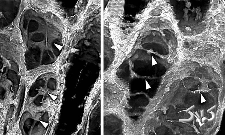 کشف فسیلی ۴۰۰ میلیونساله