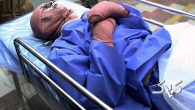 سوختگی - اسیدپاشی