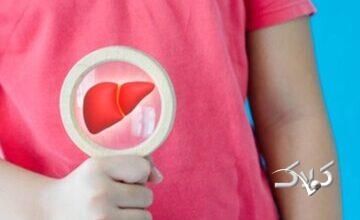 چگونه مبتلایان به کبد چرب دست از پرخوری بردارند؟