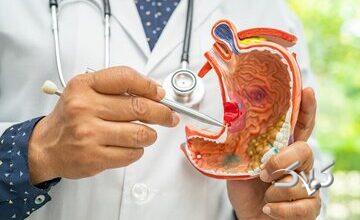 نقش پنهان آلودگی هوا در افزایش خطر بک نوع سرطان