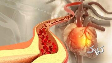 کاهش کلسترول، بدون نیاز به دارو/ چربیهای کاهنده کلسترول کدامند؟/ این ورزشها موثرند
