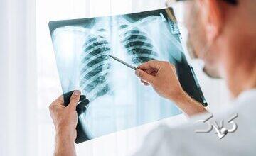 چرا آنفلوآنزا گاهی کشنده میشود؟