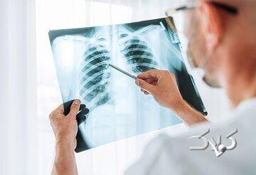 چرا آنفلوآنزا گاهی کشنده میشود؟