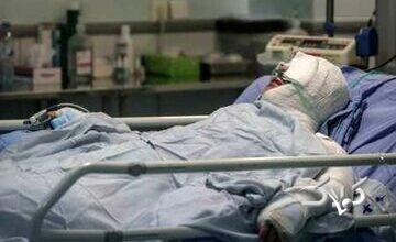 اعلام آمار سالانه سوختگی در ایران/ چند نفر از مصدومان فوت میشوند؟