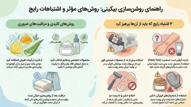 وایتنینگ بیکینی