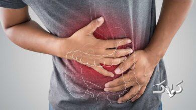 ۵ راهکار طلایی برای افزایش سلامت روده