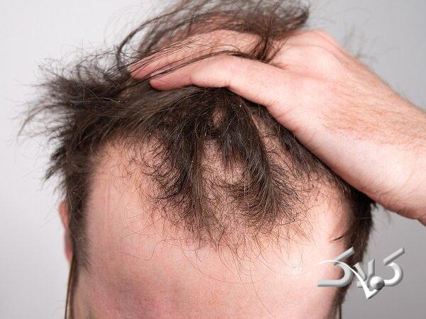 رشد و ویتامینها