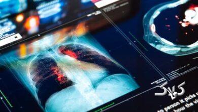 بیماری - سرطان - سلامت