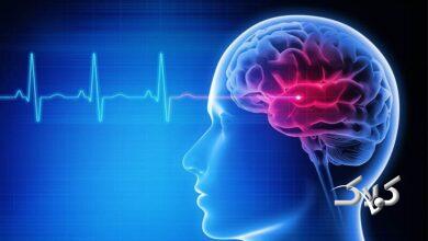 پیر شدن مغز