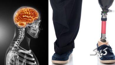 ماجرای مردی که از پزشکان خواست دو انگشتش را قطع کنند