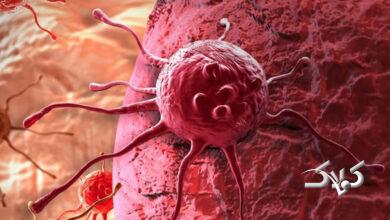 سلول سرطانی - ابتلا به سرطان