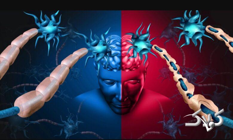 یافتهها درباره ام اس